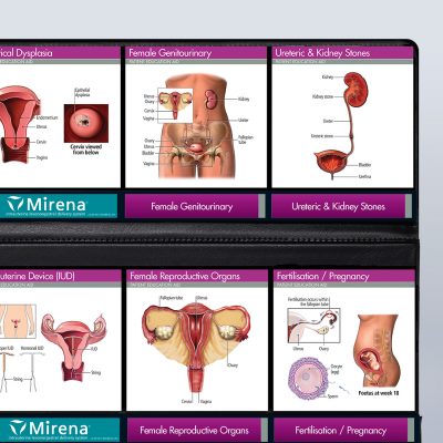 Gynaecology diagrams
